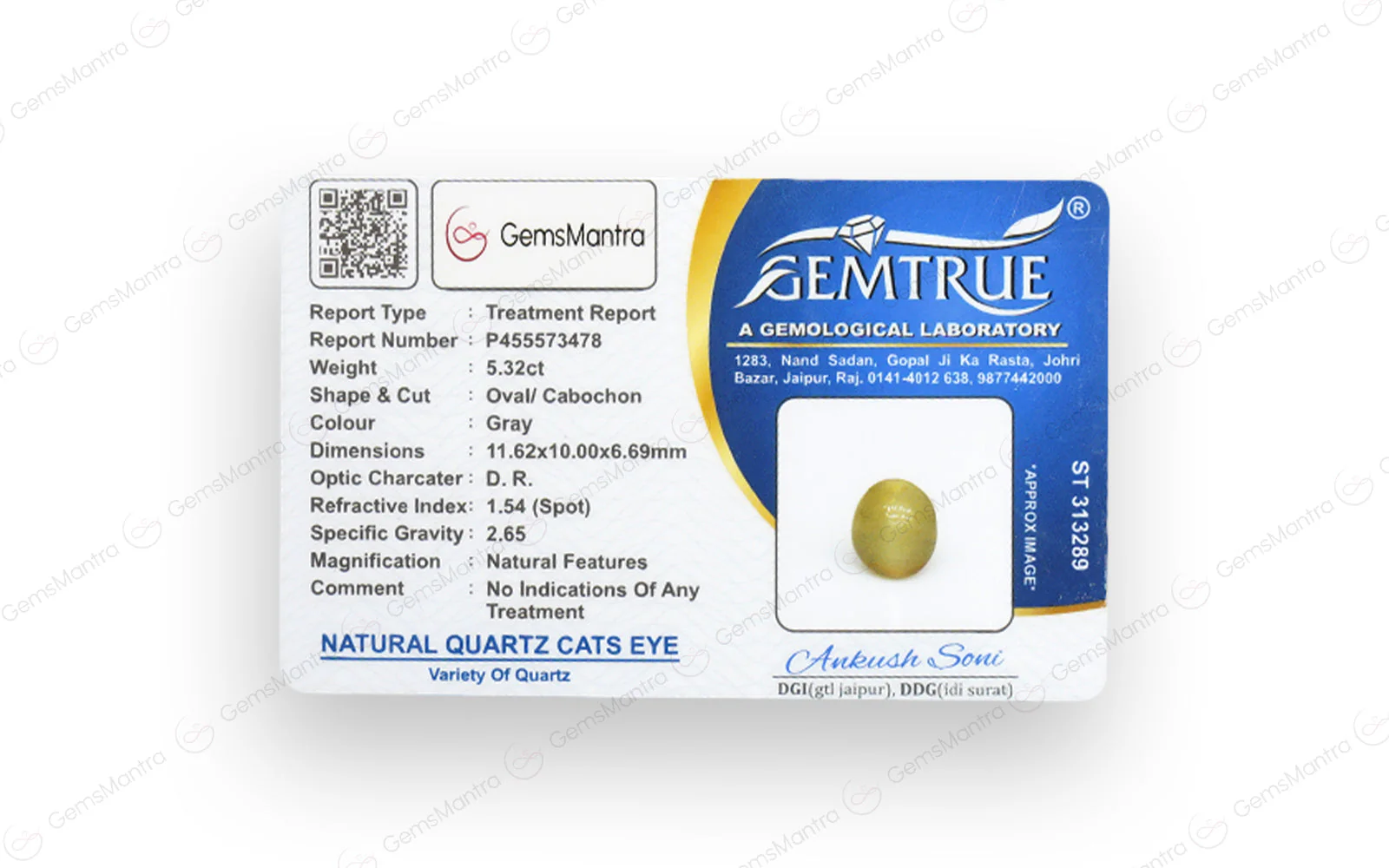 Cats Eye Quartz (Lehsunia) – 5.32 Carat / 5.9 Ratti [GM03106] - Image 4