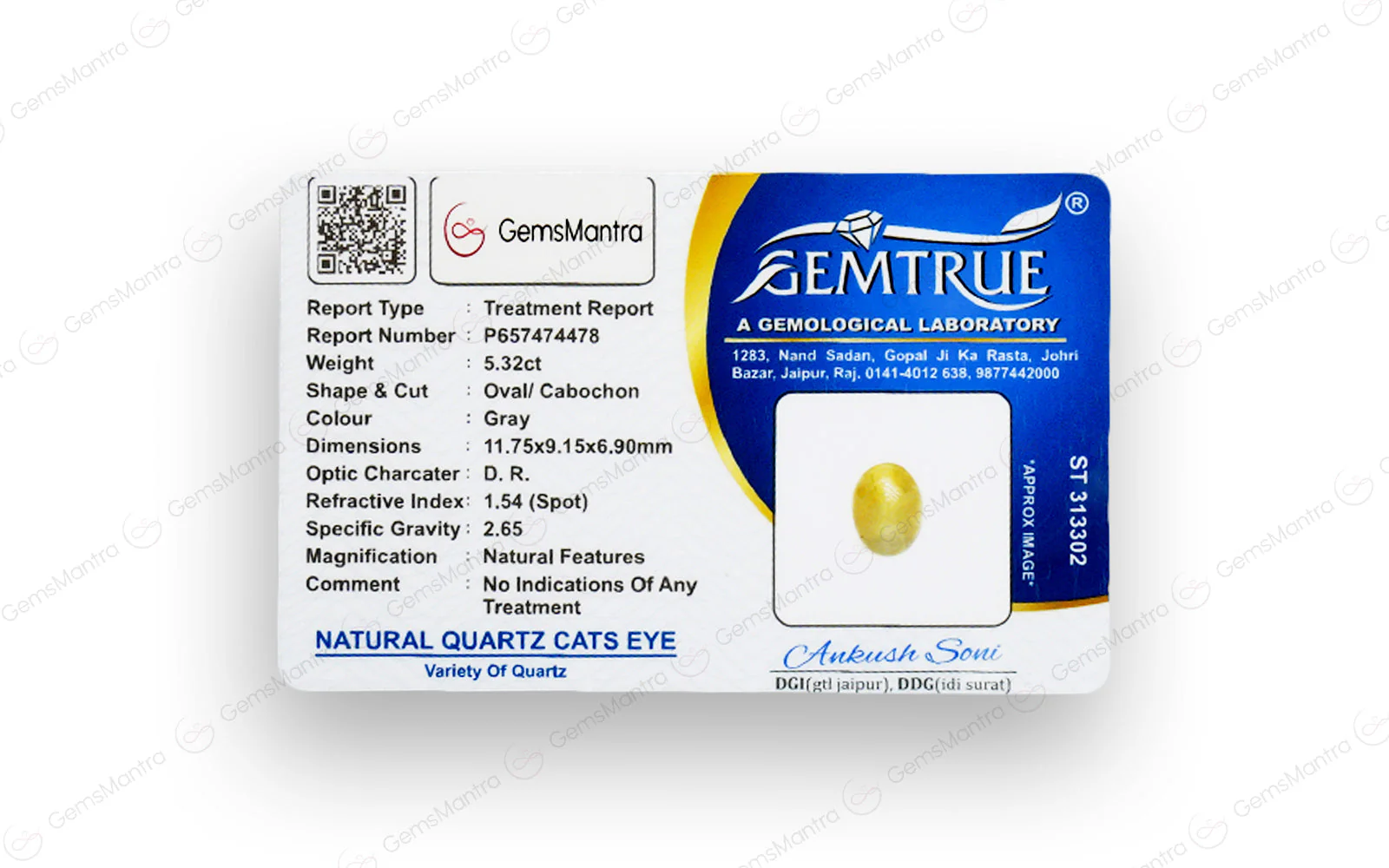 Cats Eye Quartz (Lehsunia) – 5.32 Carat / 5.9 Ratti [GM03109] - Image 4